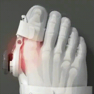 Corector Bunion Confortabil