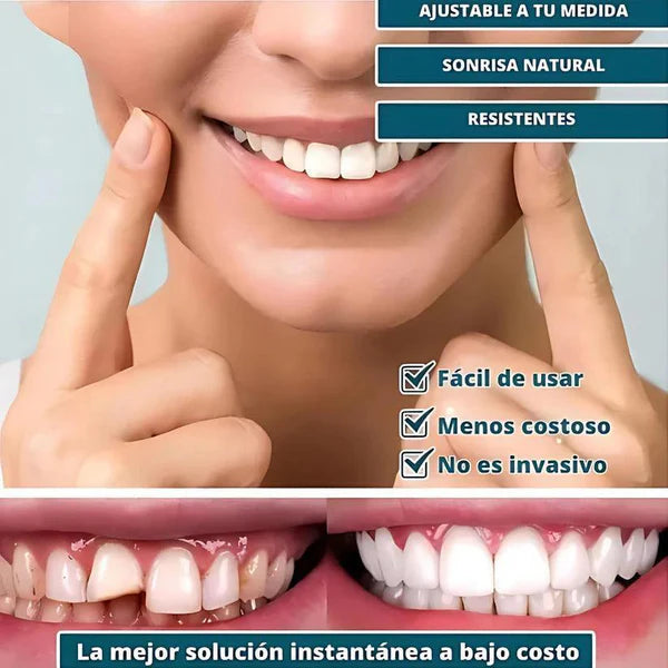 Sonrisa Pro Fácil y Natural 3